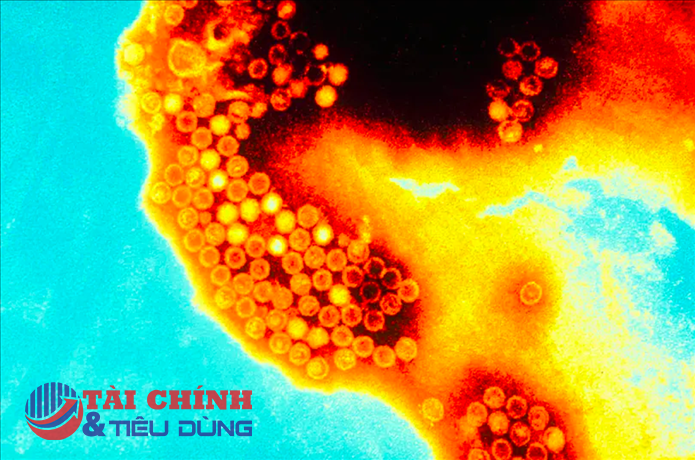 Bộ Y tế yêu cầu theo dõi chặt chẽ bệnh viêm gan cấp tính bí ẩn ở trẻ