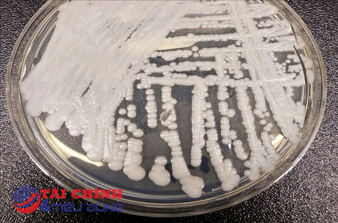 Xuất hiện loại nấm có thể gây chết người trú ngụ trong tai chó