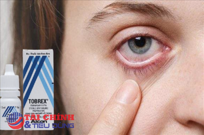 Kiểm tra việc lưu hành thuốc giả Tobramycin