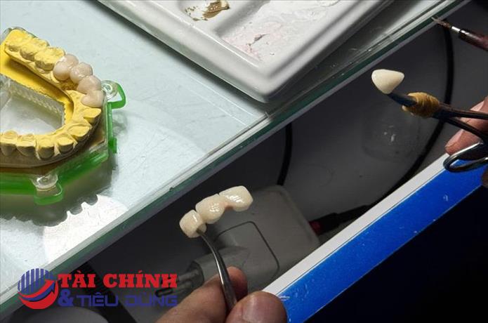 Hà Nội phát hiện nhiều vi phạm trong sản xuất, kinh doanh răng giả